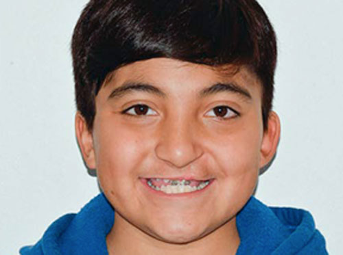 Vicente en el preescolar